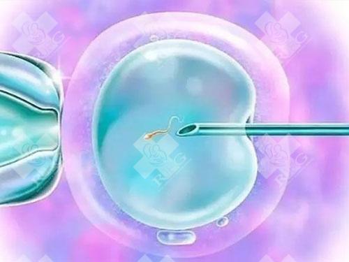 高龄35岁以上人群如何选择移植囊胚数量？