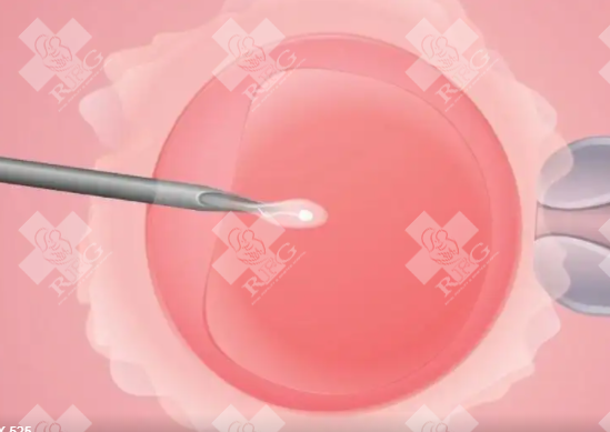 吉林永吉县试管婴儿需要多少钱?