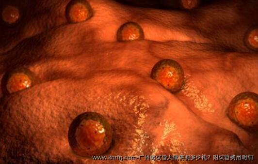 广州做试管大概需要多少钱?附试管费用明细