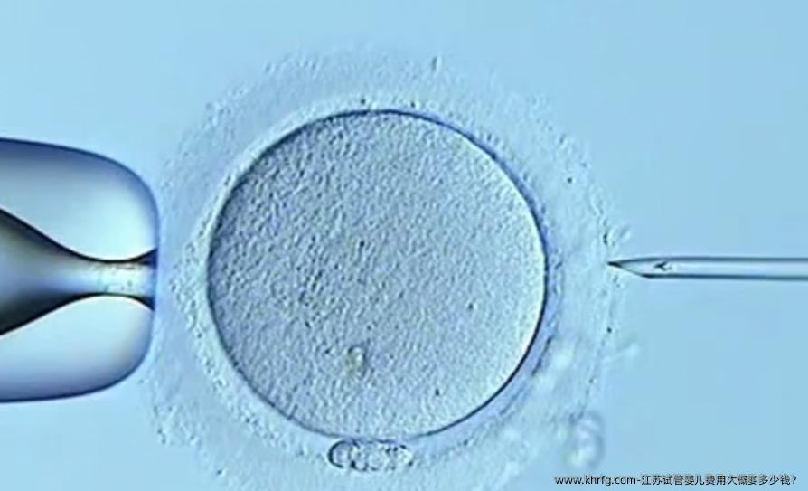 江苏试管婴儿费用大概要多少钱?