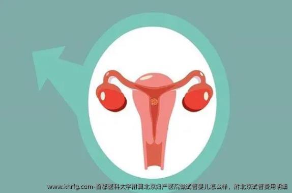 首都医科大学附属北京妇产医院做试管婴儿怎么样，附北京试管费用明细