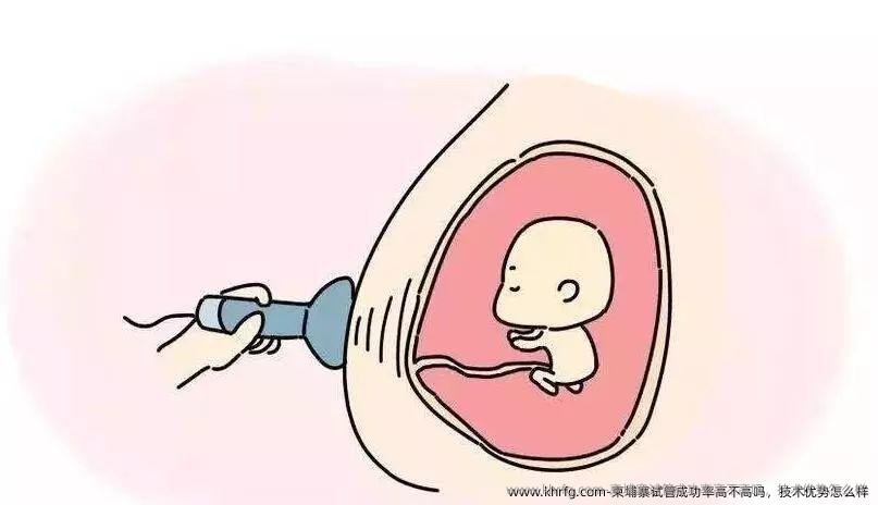 柬埔寨试管成功率高不高吗，技术优势怎么样