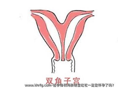 验孕棒有两条明显红杠一定是怀孕了吗？
