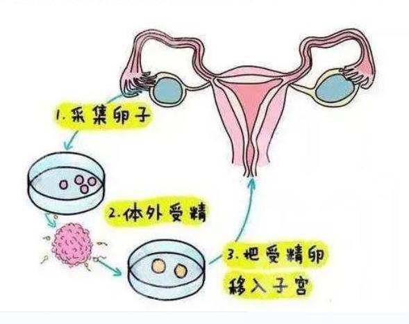 在北京试管具体是怎么操作的？
