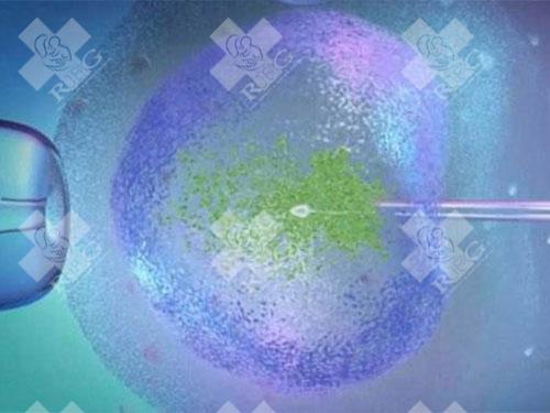 拮抗剂方案可以次月移植吗？