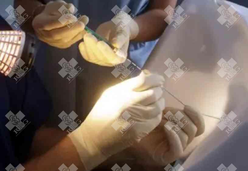 卵子质量受哪些因素影响?应该如何提高卵子质量呢?