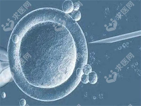 男性精液检查主要是看什么？精液检查前注意事项！
