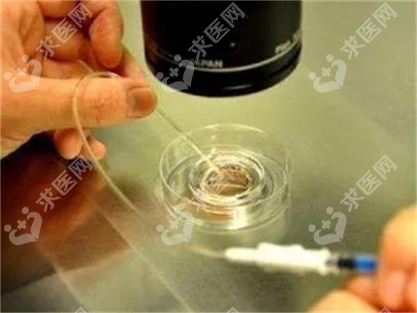备孕期间如何运动？掌握正确的运动方法很重要！