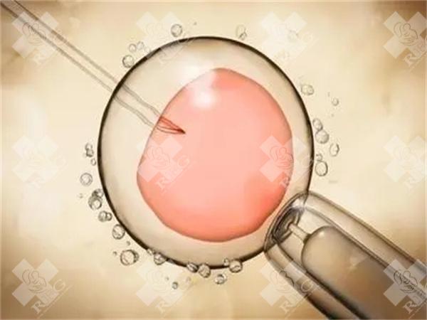 柬埔寨试管成功率受年龄影响吗?有哪些注意事项?