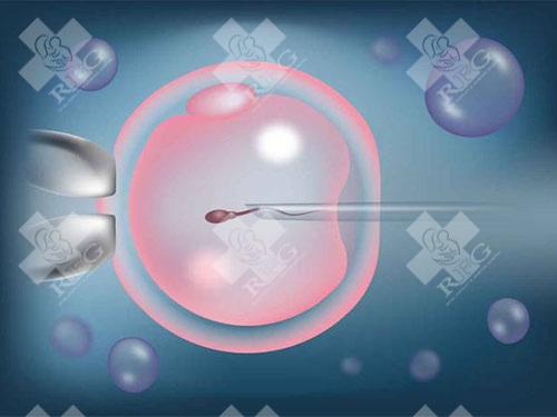 在做试管婴儿移植前需要做输卵管造影吗？有哪些好处？