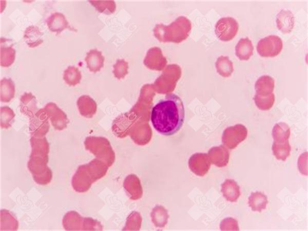 试管调理方法有哪些?试管前如何调理身体可以提高成功率!