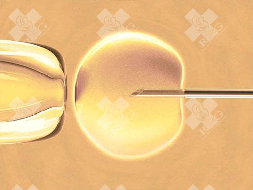试管后50天下腹部揪着疼属于早期正常症状吗？