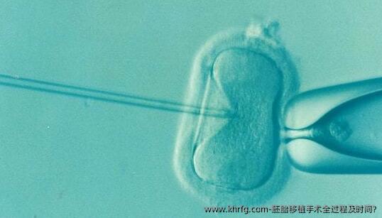 胚胎移植手术全过程及时间?