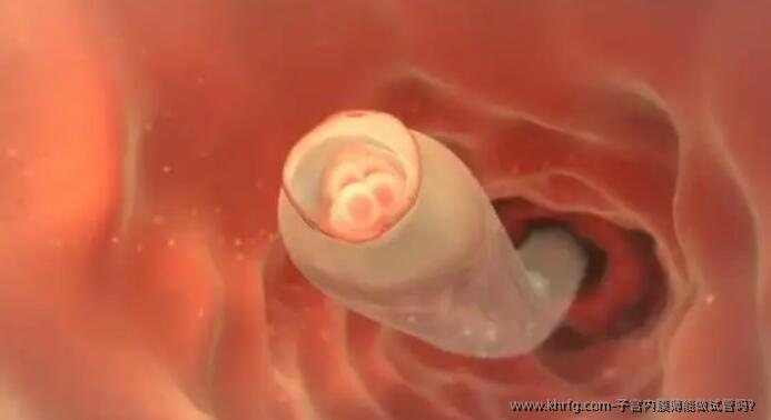 子宫内膜薄能做试管吗?