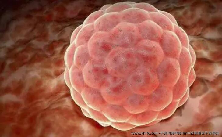 子宫内膜厚度4mm试管着床不容易吗