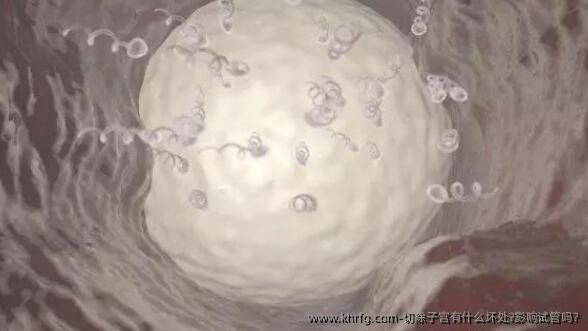 切除子宫有什么坏处?影响试管吗?