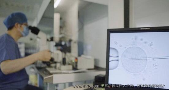 子宫后位是什么意思，对试管有影响吗？