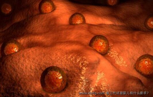 做三代试管婴儿有什么要求?