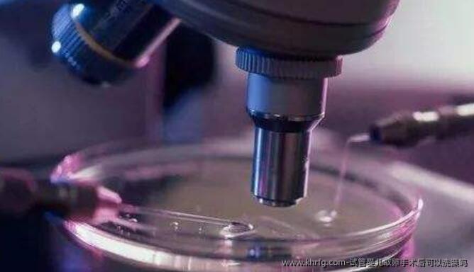 试管婴儿卵泡取出手术后可以洗澡吗