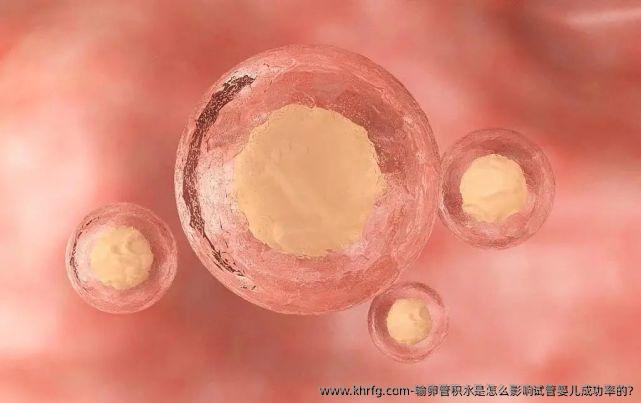 输卵管积水是怎么影响试管婴儿成功率的?