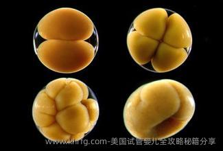 美国试管婴儿全攻略秘籍分享