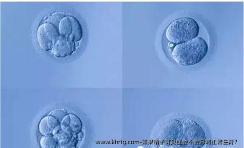 如果精子有炎症会不会影响正常生育？