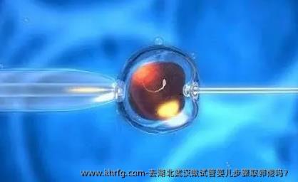 去湖北武汉做试管婴儿步骤卵泡取出疼吗？