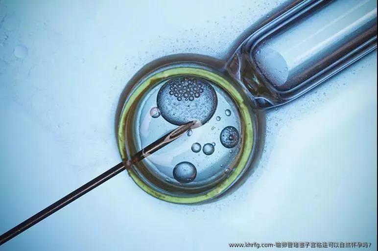 输卵管堵塞子宫粘连可以自然怀孕吗？