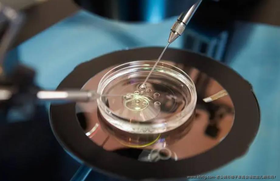 老公畸形精子率高会导致胎儿畸形吗？