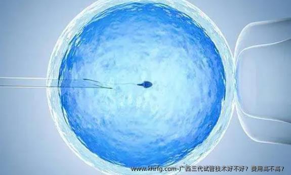 广西三代试管技术好不好？费用高不高？