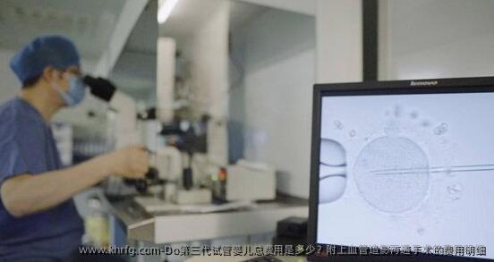 Do第三代试管婴儿总费用是多少?附上血管造影再通手术的费用明细