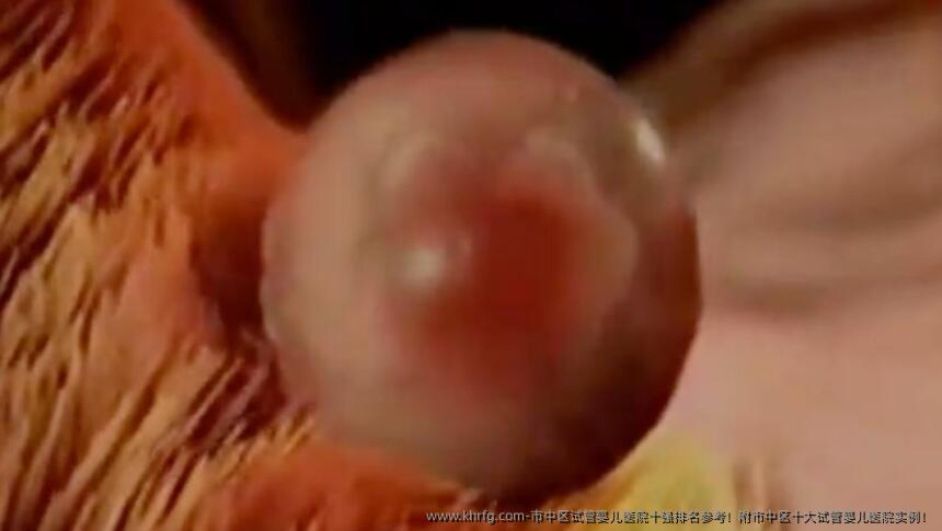 市中区试管婴儿医院十强排名参考!附市中区十大试管婴儿医院实例!