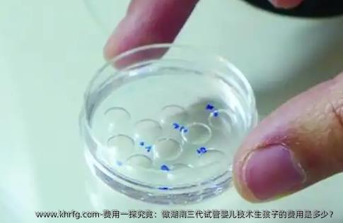 费用一探究竟：做湖南三代试管婴儿技术生孩子的费用是多少？