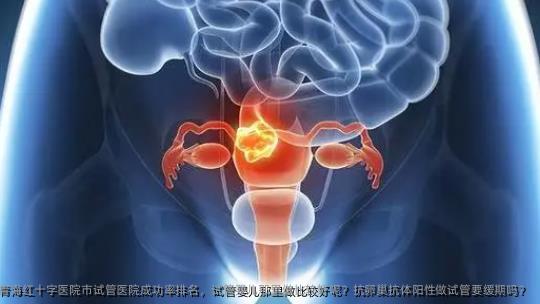 青海红十字医院市试管医院成功率排名，试管婴儿那里做比较好呢？抗卵巢抗体阳性做试管要缓期吗？