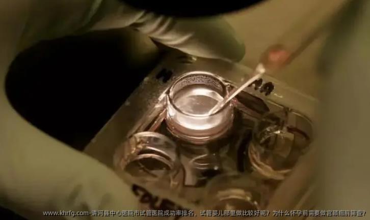 清河县中心医院市试管医院成功率排名，试管婴儿那里做比较好呢？为什么怀孕前需要做宫颈癌前筛查?