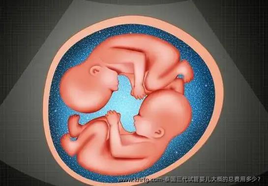 泰国三代试管婴儿大概的总费用多少？
