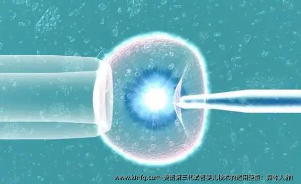 美国第三代试管婴儿技术的适用范围：具体人群！