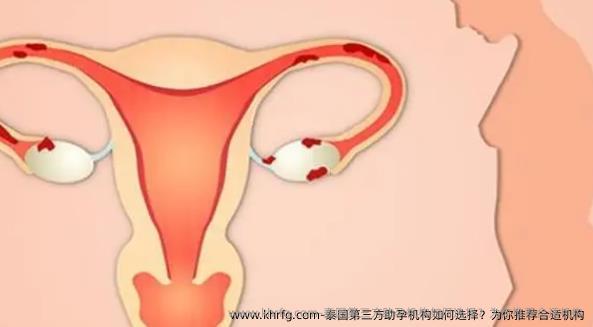 泰国三方助孕机构如何选择？为你推荐合适机构