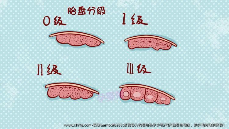 昆明​试管婴儿的费用是多少钱?附详细费用揭秘，助你清晰规划预算！