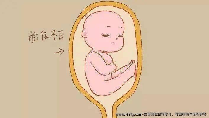 去泰国做试管婴儿：详细指南与全程解答