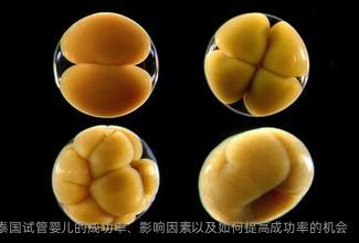 泰国试管婴儿的成功率、影响因素以及如何提高成功率的机会