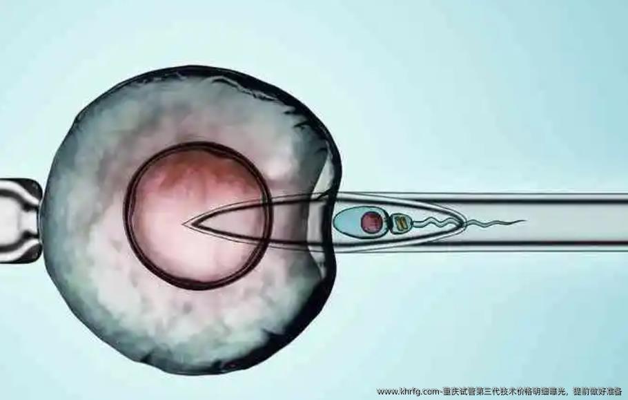 重庆试管第三代技术价格明细曝光，提前做好准备