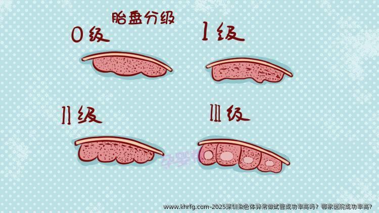 2025深圳染色体异常做试管成功率高吗？哪家医院成功率高？