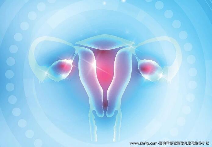 临汾市做试管婴儿要准备多少钱