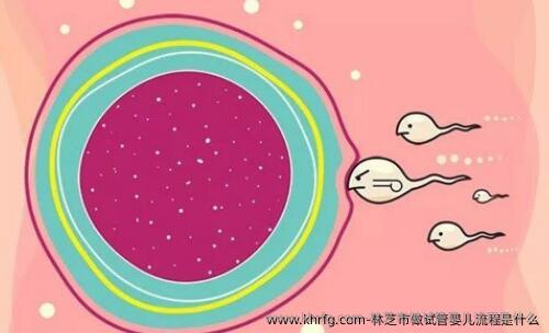 林芝市做试管婴儿流程是什么