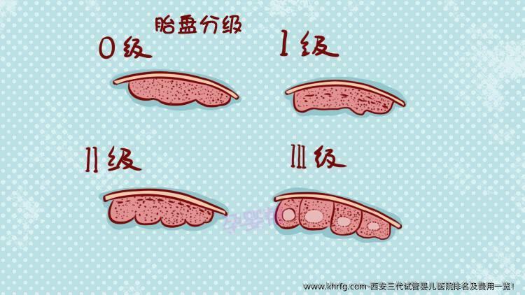 西安三代试管婴儿医院排名及费用一览！