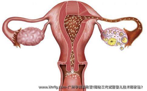 广州孕育新希望!揭秘三代试管婴儿技术哪家强？