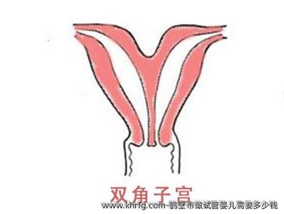 鹤壁市做试管婴儿需要多少钱