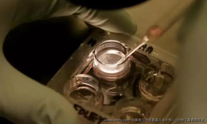 云南做三代试管婴儿多少钱？1分钟了解费用开支