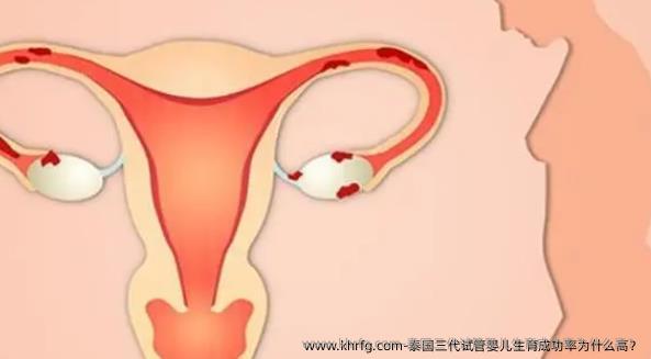 泰国三代试管婴儿生育成功率为什么高？